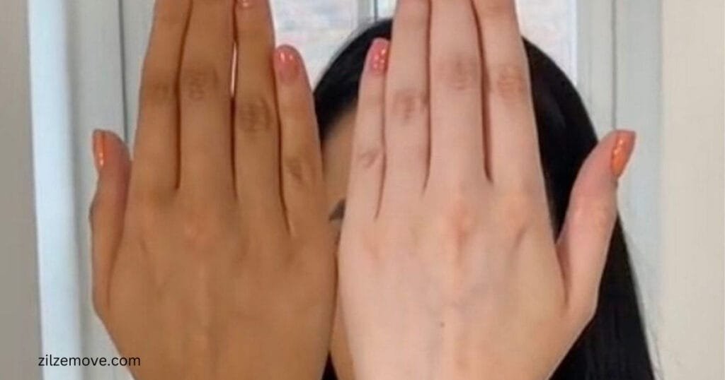 How can I remove dark from my hand? Home remedies to get rid of dark knuckles